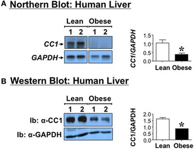 Reduced Hepatic Carcinoembryonic Antigen-Related Cell Adhesion Molecule 1 Level in Obesity